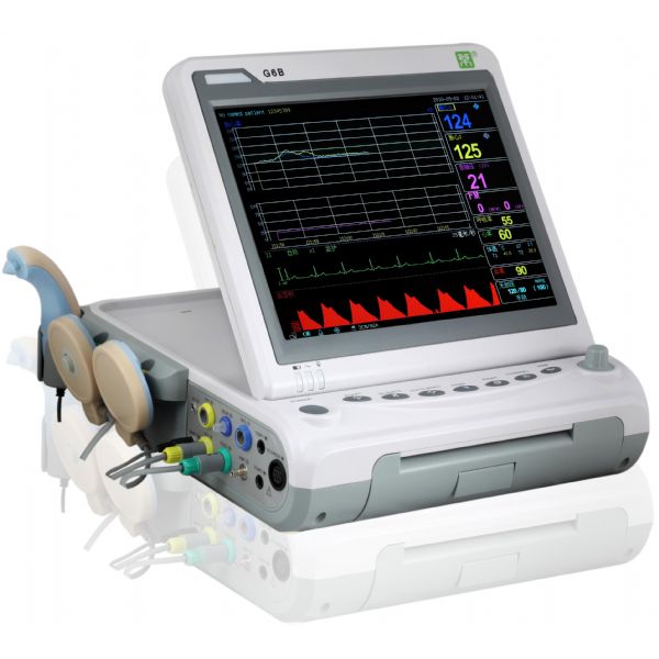 FETAL MONTR (NST)